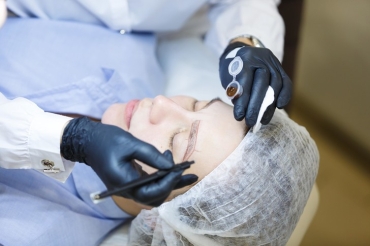 Трансплантация бровей: кто и зачем делает трендовую операцию по пересадке волос?