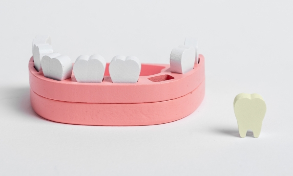 Зубы мудрости: почему врачи советуют их удалять